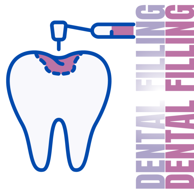 Dental Filling
