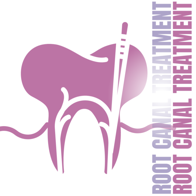 Root Canal Treatment
