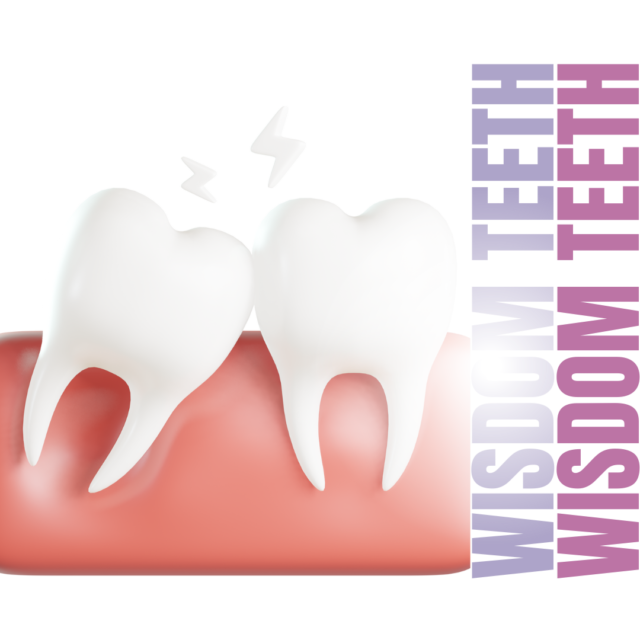 Wisdom Teeth