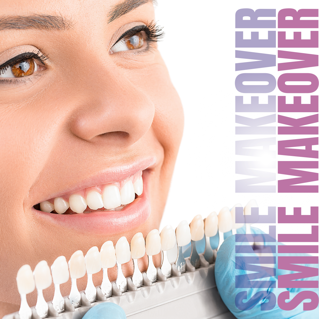 Smile Makeover Treatment